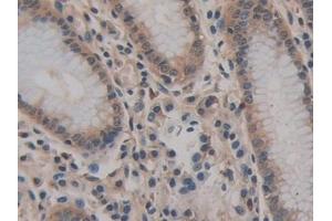 Detection of CD147 in Human Stomach Tissue using Polyclonal Antibody to Cluster Of Differentiation 147 (CD147)