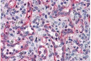 Human Spleen: Formalin-Fixed, Paraffin-Embedded (FFPE)