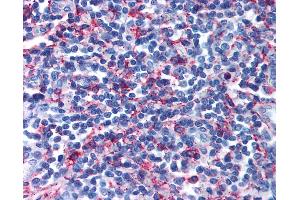 Anti-GPR44 / CRTH2 antibody IHC of human tonsil.