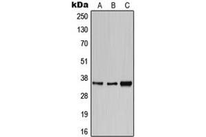 Western blot analysis of CD1e expression in HeLa (A), SP2/0 (B), H9C2 (C) whole cell lysates. (CD1e anticorps  (Center))