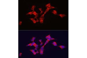 Immunofluorescence analysis of SH-SY5Y cells using BSCL2 antibody (ABIN7265874) at dilution of 1:100.