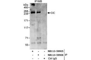 Detection of Human CIC/Capicua by Western blot of Immunoprecipitates. (CIC anticorps)