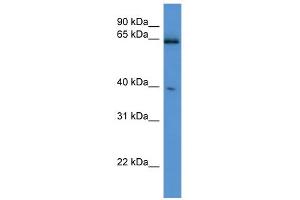 WB Suggested Anti-Asrgl1 Antibody Titration: 0. (ASRGL1 anticorps  (C-Term))