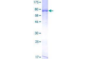 Image no. 1 for Aspartyl Aminopeptidase (DNPEP) (AA 1-475) protein (GST tag) (ABIN1351875)