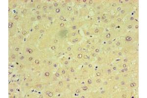 Immunohistochemistry of paraffin-embedded human liver tissue using ABIN7159923 at dilution of 1:100 (CHCHD4 anticorps  (AA 1-142))