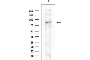 Western blot analysis of lysates from COLO205 cells(heat-shock treatment), using Gab2 Antibody at 1/1000 dilution.