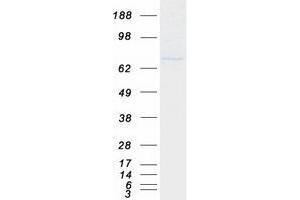 Validation with Western Blot