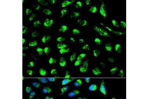 Immunofluorescence analysis of HeLa cells using ECI1 Polyclonal Antibody (DCI anticorps)