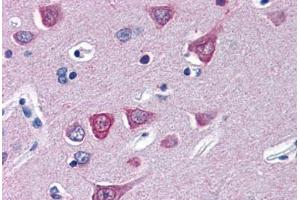 anti-Suppressor of Cytokine Signaling 1 (SOCS1) (N-Term) antibody