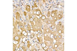 Immunohistochemistry of paraffin-embedded mouse spleen using Ferritin Light Chain Rabbit pAb (ABIN6133515, ABIN6140791, ABIN6140792 and ABIN6218871) at dilution of 1:150 (40x lens).