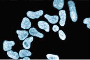 Immunofluorescence staining of HeLa cells (Human cervical epitheloid carcinoma, ATCC CCL-2.