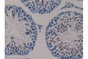 Detection of KL in Mouse Testis Tissue using Polyclonal Antibody to Klotho (KL)