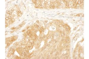Immunohistochemistry (IHC) image for anti-Yes-Associated Protein 1 (YAP1) (AA 350-400) antibody (ABIN7453409)
