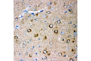 Anti- GRIA2 antibody, IHC(P) IHC(P): Mouse Brain Tissue (GRIA2 anticorps  (AA 25-360))