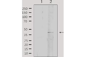 Western blot analysis of extracts from rat brain, using Collagen IV α2 Antibody.
