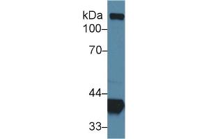Detection of ALDOA in Mouse Cerebrum lysate using Polyclonal Antibody to Aldolase A, Fructose Bisphosphate (ALDOA)