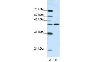 NMUR2 antibody used at 2. (NMUR2 anticorps  (N-Term))