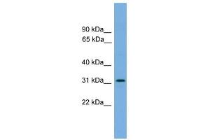 DAPP1 antibody used at 1 ug/ml to detect target protein. (DAPP1 anticorps  (Middle Region))
