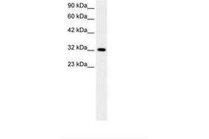 Image no. 1 for anti-E2F5 (E2F5) (AA 134-183) antibody (ABIN6736272) (E2F5 anticorps  (AA 134-183))