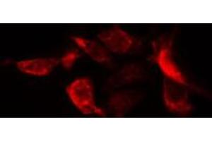 ABIN6274752 staining HuvEc cells by IF/ICC. (RPS20 anticorps  (Internal Region))
