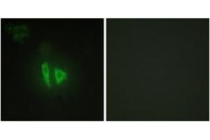 Immunofluorescence analysis of HepG2 cells, using AKAP11 Antibody. (AKAP11 anticorps  (AA 1761-1810))