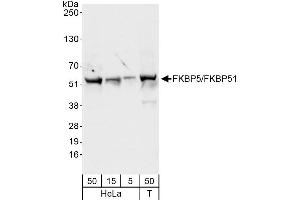 Western Blotting (WB) image for anti-FK506 Binding Protein 5 (FKBP5) (AA 407-457) antibody (ABIN7454751)