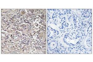 Immunohistochemistry (IHC) image for anti-Claudin 6 (CLDN6) (Internal Region) antibody (ABIN1851126) (Claudin 6 anticorps  (Internal Region))