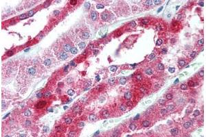 Human Kidney (formalin-fixed, paraffin-embedded) stained with OCLN antibody ABIN305888 at 2.