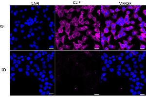 Immunocytochemical staining of HeLa cells using CLIP1 antibody (ABIN7797861), 1:1,000), Top panel: wild-type (WT), Bottom panal: CLIP1 shRNA knockdown (KD). (Recombinant CLIP1 anticorps)