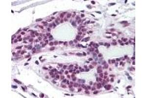 Immunohistochemistry (IHC) image for anti-Zinc Finger, MYM-Type 2 (ZMYM2) (AA 1250-1300) antibody (ABIN2469808)