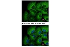 ICC/IF Image Immunofluorescence analysis of methanol-fixed H1299, using MMP12, antibody at 1:500 dilution. (MMP12 anticorps)