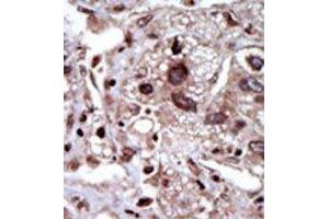Image no. 1 for anti-serine threonine Kinase 39 (STK39) (Middle Region) antibody (ABIN360385) (STK39 anticorps  (Middle Region))