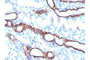 Formalin-fixed, paraffin-embedded Rat Kidney stained with KSP-Cadherin Rabbit Recombinant Monoclonal Antibody (CDH16/1532R)