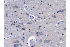 Detection of Grb7 in Porcine Cerebrum Tissue using Polyclonal Antibody to Growth Factor Receptor Bound Protein 7 (Grb7)