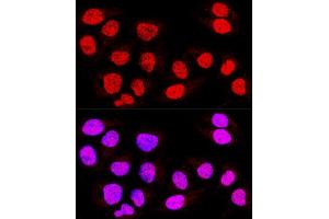 Confocal immunofluorescence analysis of U-2 OS cells using TE Polyclonal Antibody (ABIN6128816, ABIN6148986, ABIN6148987 and ABIN6223335) at dilution of 1:400.