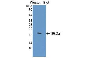 Western blot analysis of the recombinant protein. (Calcitonin Receptor anticorps  (AA 42-170))