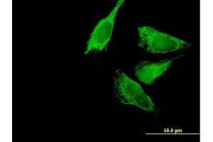 Immunofluorescence of purified MaxPab antibody to BCKDK on HeLa cell.