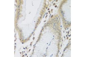Immunohistochemistry of paraffin-embedded human stomach using ENPEP antibody  at dilution of 1:200 (40x lens). (ENPEP anticorps  (AA 708-957))