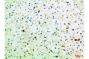 Immunohistochemical analysis of paraffin-embedded Human-brain, antibody was diluted at 1:100
