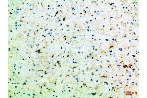 Immunohistochemical analysis of paraffin-embedded Human-brain, antibody was diluted at 1:100 (FZD4 anticorps  (AA 11-60))
