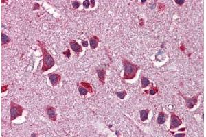 Human Brain, Cortex: Formalin-Fixed, Paraffin-Embedded (FFPE)