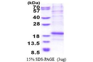 SDS-PAGE (SDS) image for Leukocyte Cell Derived Chemotaxin 1 (LECT1) (AA 214-333) protein (His tag) (ABIN5853515)