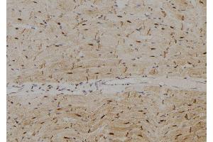 ABIN6265270 and ABIN6278780 at 1/100 staining Rat heart tissue by IHC-P. (SPZ1 anticorps  (Internal Region))