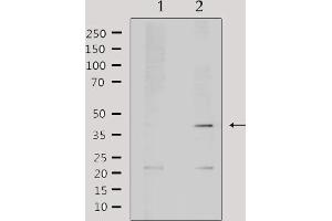 Western blot analysis of extracts from mouse brain, using AIM2 Antibody. (AIM2 anticorps  (Internal Region))