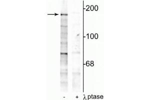 Western blot of rat hippocampal lysate showing specific immunolabeling of the ~180 kDa NR2B subunit phosphorylated at Tyr1252 in the first lane (-). (GRIN2B anticorps  (pTyr1252))