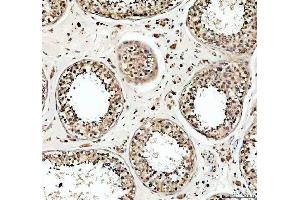 anti-Ubiquitin Specific Peptidase 5 (USP5) (AA 1-800) antibody