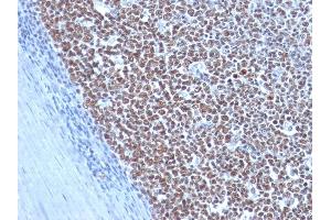 Formalin-fixed, paraffin-embedded human Tonsil stained with Cyclin B1 Mouse Monoclonal Antibody (CCNB1/1098).