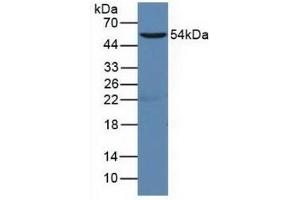 Detection of CD19 in Human Raji Cells using Polyclonal Antibody to Cluster Of Differentiation 19 (CD19)