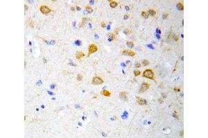 IHC-P: 5HT2A Receptor antibody testing of rat brain tissue