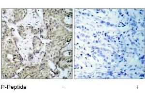 Image no. 2 for anti-Mitogen-Activated Protein Kinase Kinase 3 (MAP2K3) (pSer189) antibody (ABIN196862)